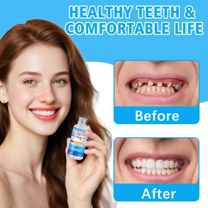 Tooth Repair Kit - Moldable False Teeth Beads for DIY Temporary Dentures