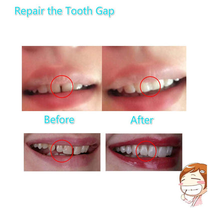 Tooth Repair Kit - Instant Temporary Teeth Replacement