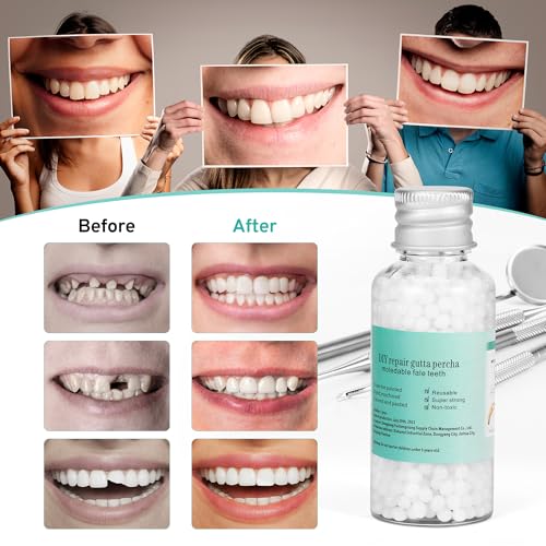 Tooth Repair Kit with 4 Dental Tools – Temporary Tooth Replacement, Moldable Fix