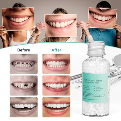 Tooth Repair Kit with 4 Dental Tools – Temporary Tooth Replacement, Moldable Fix
