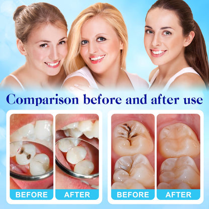 Tooth Repair Kit – Zinc Oxide Eugenol Cement for Temporary Teeth Restoration