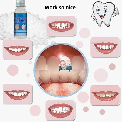 Tooth Repair Kit – Moldable Tooth Filling DIY Dental Care