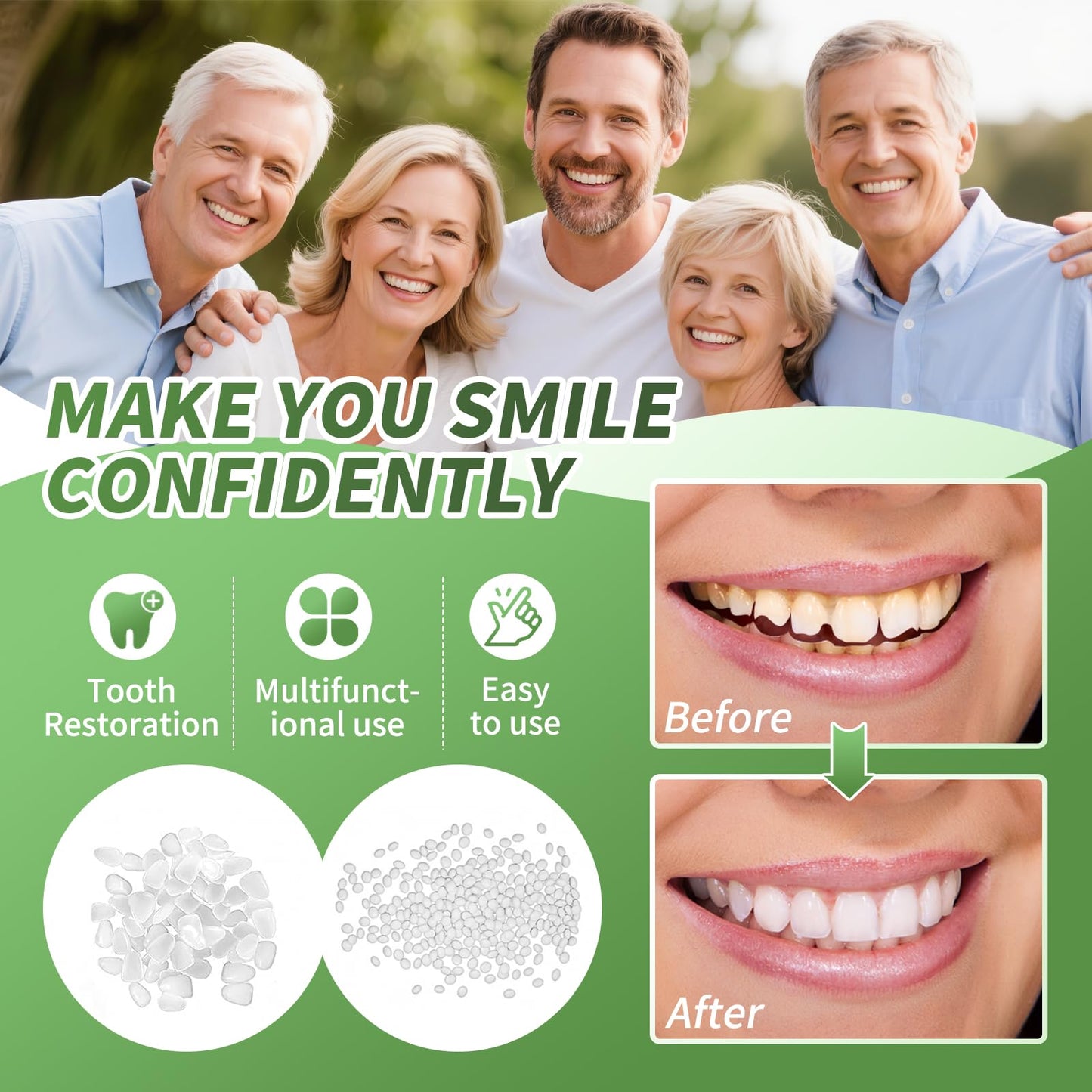 Tooth Repair Kit for Missing or Broken Teeth – Moldable Beads White A04