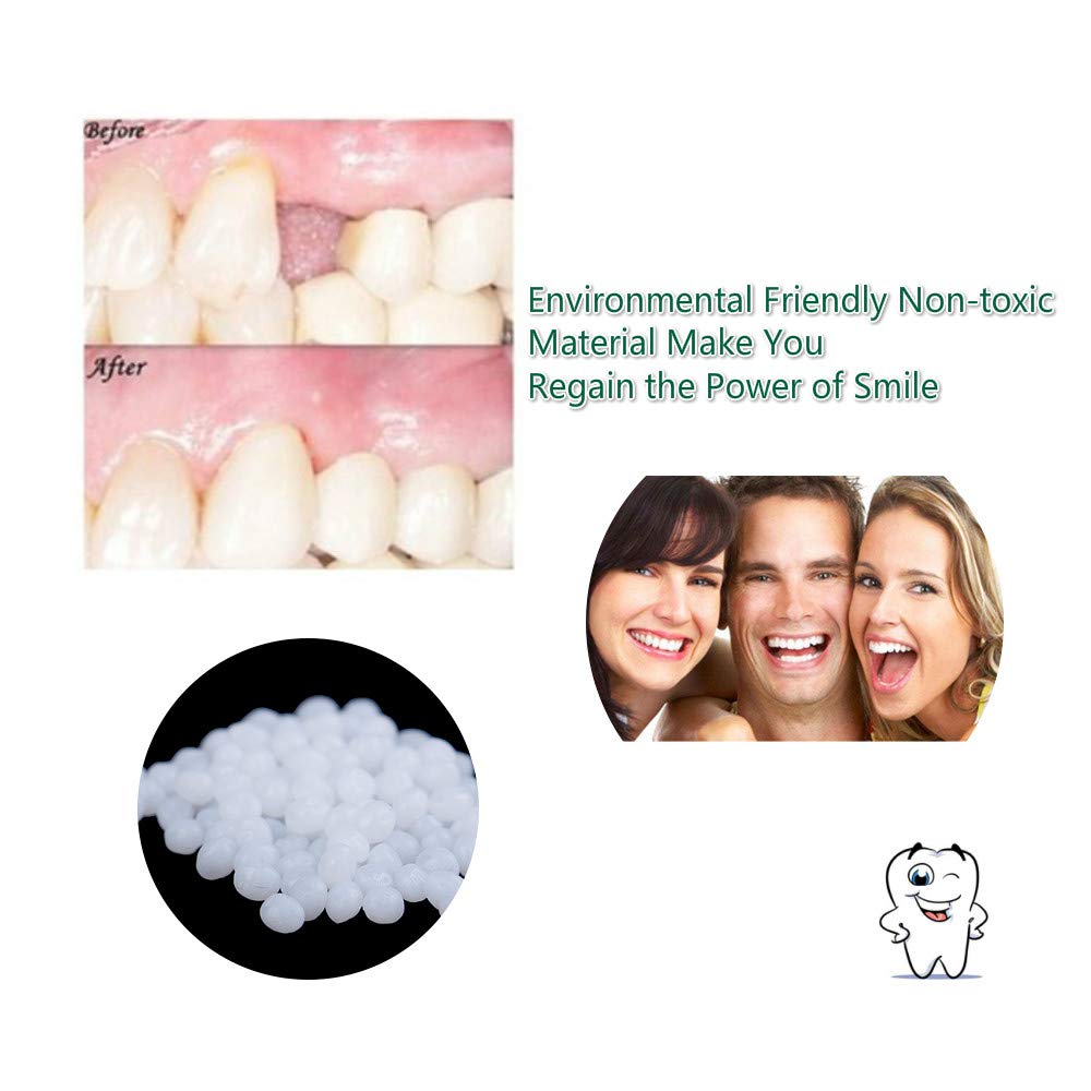 Tooth Repair Kit - Instant Temporary Teeth Replacement
