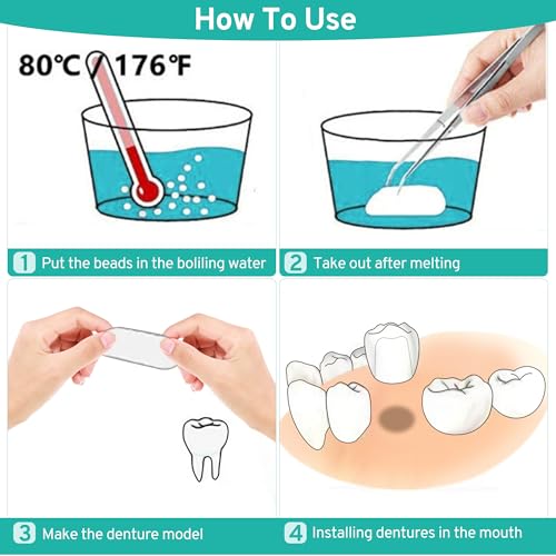 Tooth Repair Kit with 4 Dental Tools – Temporary Tooth Replacement, Moldable Fix
