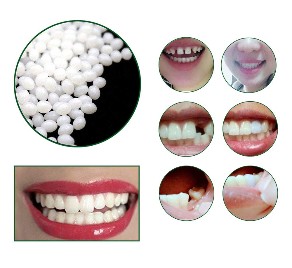 Tooth Repair Kit - Instant Temporary Teeth Replacement