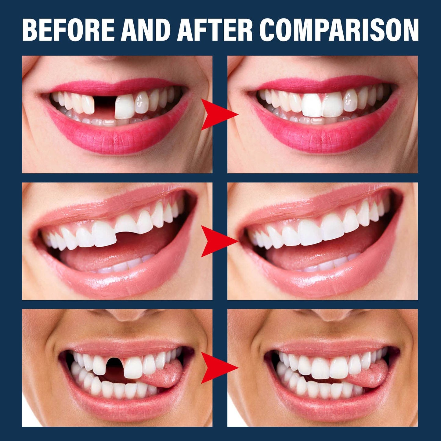 Tooth Repair Kit - Temporary Fake Teeth Replacement with Dental Mirror Tools | Ceonam