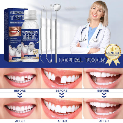 Tooth Repair Kit – Moldable Tooth Filling & DIY Dental Restoration