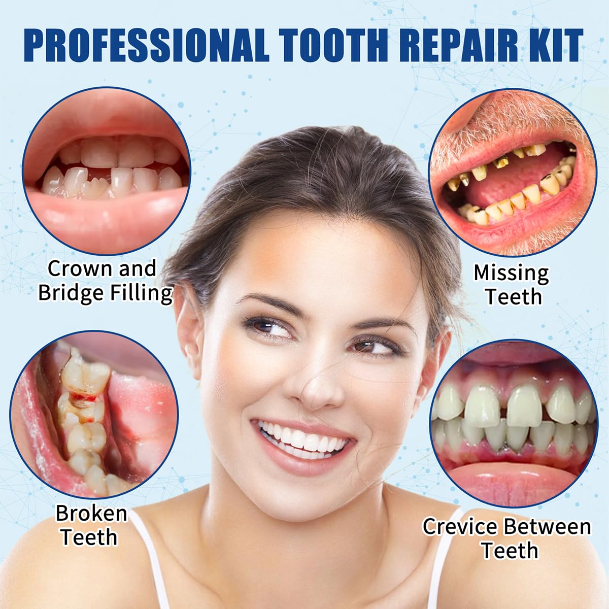 Tooth Repair Kit – Temporary Filling for Missing & Broken Teeth (Men & Women)