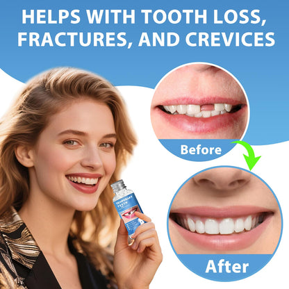 Tooth Repair Kit | Moldable False Teeth Beads for Temporary Dental Restoration | DIY Denture Kit (1 PCS)
