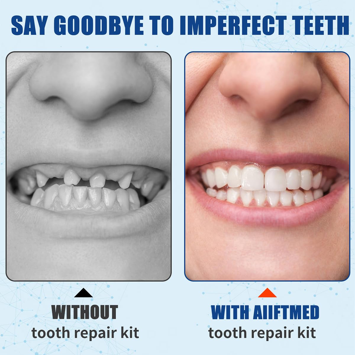 Tooth Repair Kit – Temporary Filling for Missing & Broken Teeth (Men & Women)