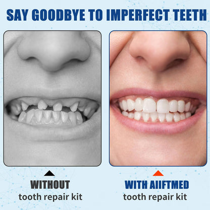 Tooth Repair Kit – Temporary Filling for Missing & Broken Teeth (Men & Women)