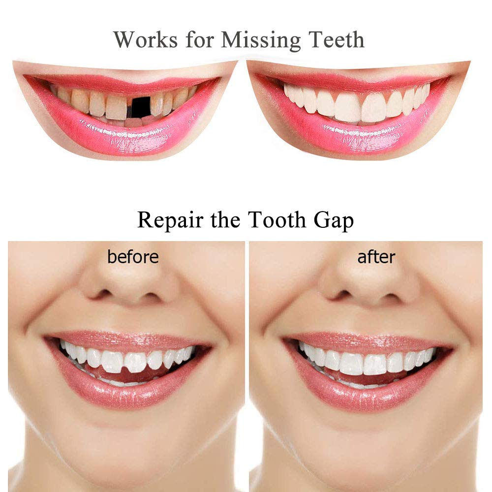 Tooth Repair Kit - Thermal Beads for Filling Gaps & Broken Teeth