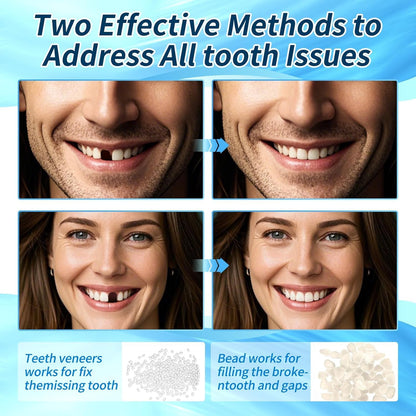 Tooth Repair Kit - Moldable Teeth & Thermal Beads (Natural Color) BB1