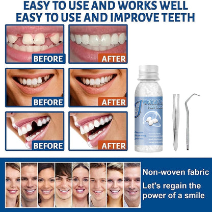 Tooth Repair Kits: 2x30ml Moldable Denture Beads + 4 Tools (2+4 Pack)