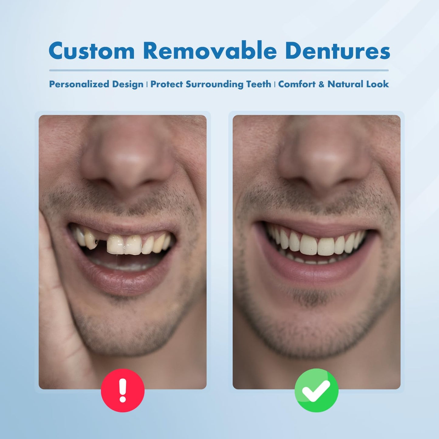 Custom Removable Dentures – Personalized Partial Dentures with Storage Case (1-6 Teeth)