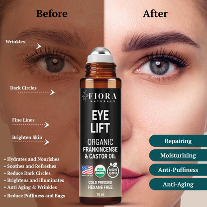Organic Castor Oil & Frankincense Roll-On – Hexane-Free Eye Oil | Fiora Naturals