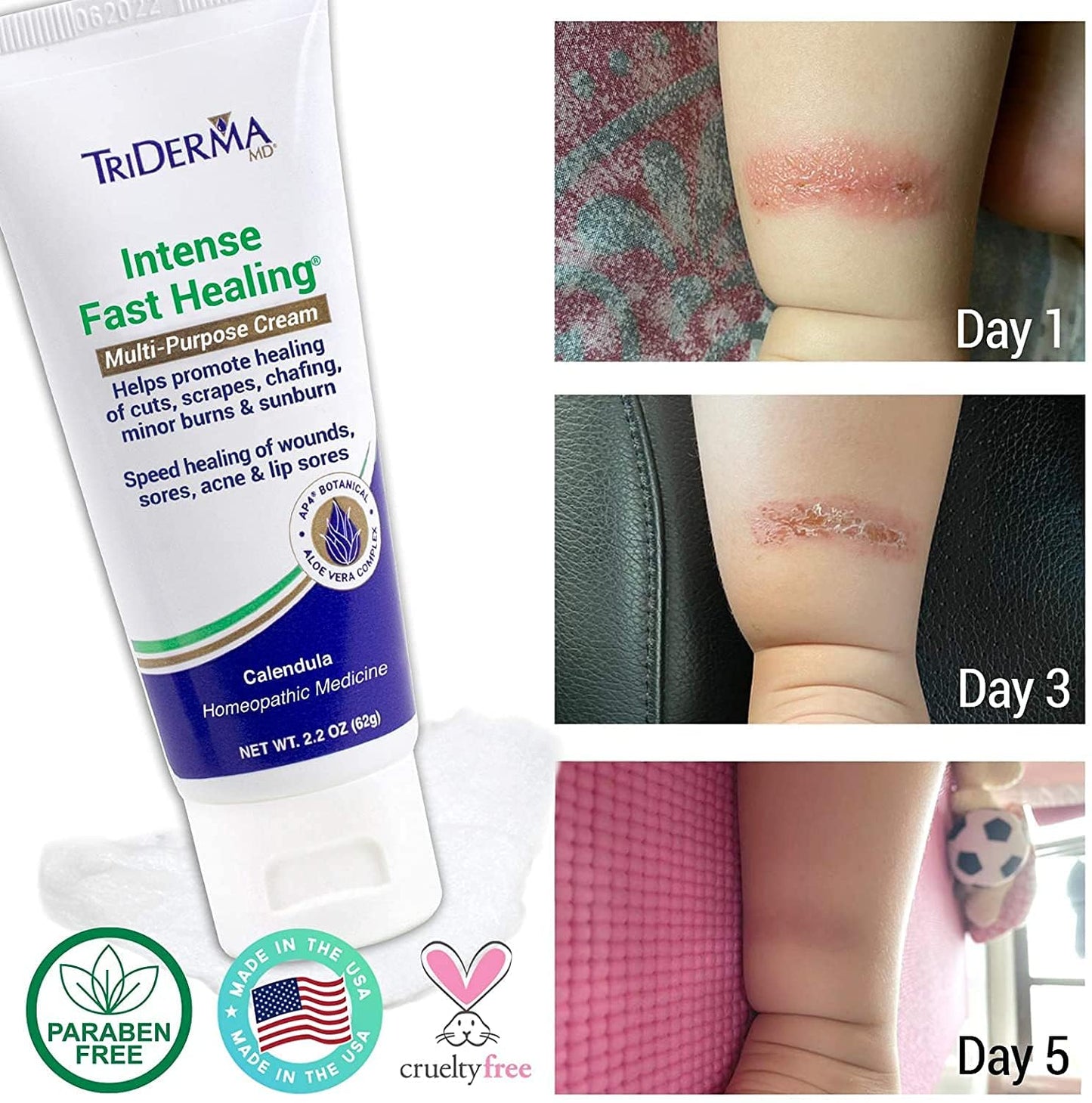 TriDerma MD Intense Fast Healing Cream – FSA Eligible, 2.2 oz