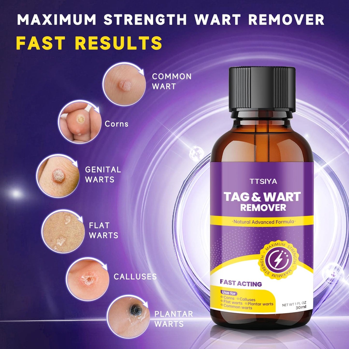 TTsiya Wart Remover Freeze Off – Fast-Acting Salicylic Acid Liquid (30 ml)