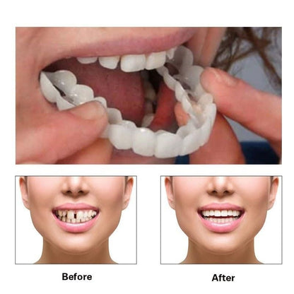 2 Pairs Temporary Smile Supports - Top & Bottom, Natural White, Comfortable