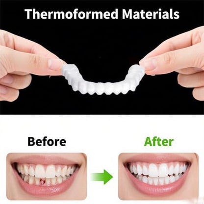 2 Pairs Temporary Smile Enhancer – Comfortable, Adjustable for Men & Women | White