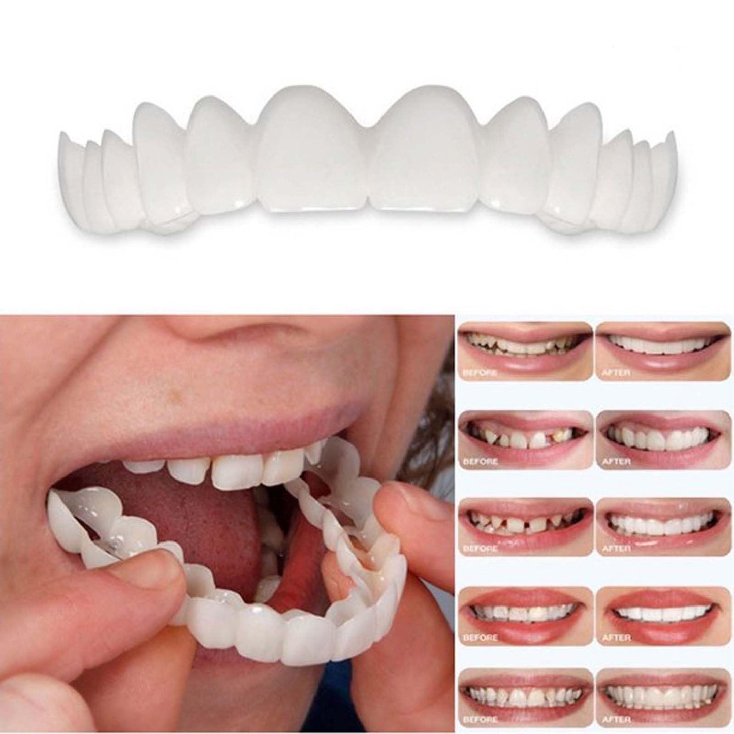 2 Pairs Temporary Smile Enhancer – Comfortable, Adjustable for Men & Women | White