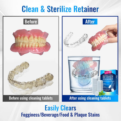Retainer Cleaner Tablets for Invisalign – Sulphate-Free Effervescent Cleaner with Aligner Tools