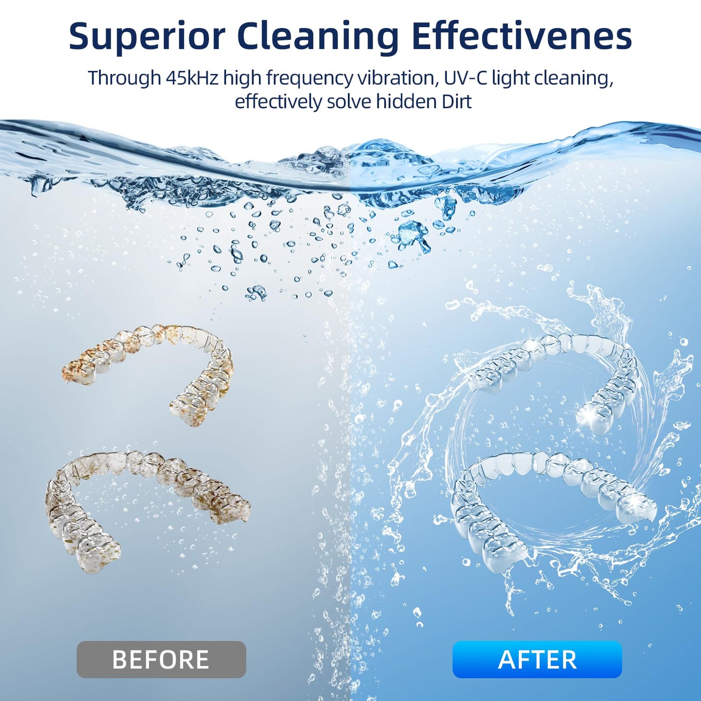 Ultrasonic Retainer Cleaner 200ml – 45kHz, 4 Modes for Dentures, Braces & Jewelry