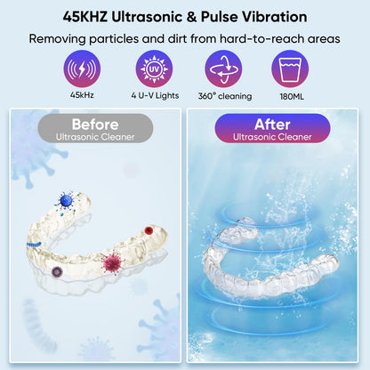 Ultrasonic Retainer Cleaner 45kHz – 180ml, 2 Modes for Dentures, Aligners & Jewelry
