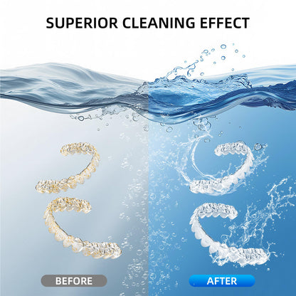 Ultrasonic Retainer Cleaner Machine - 48kHz Cleaning (13oz, White)