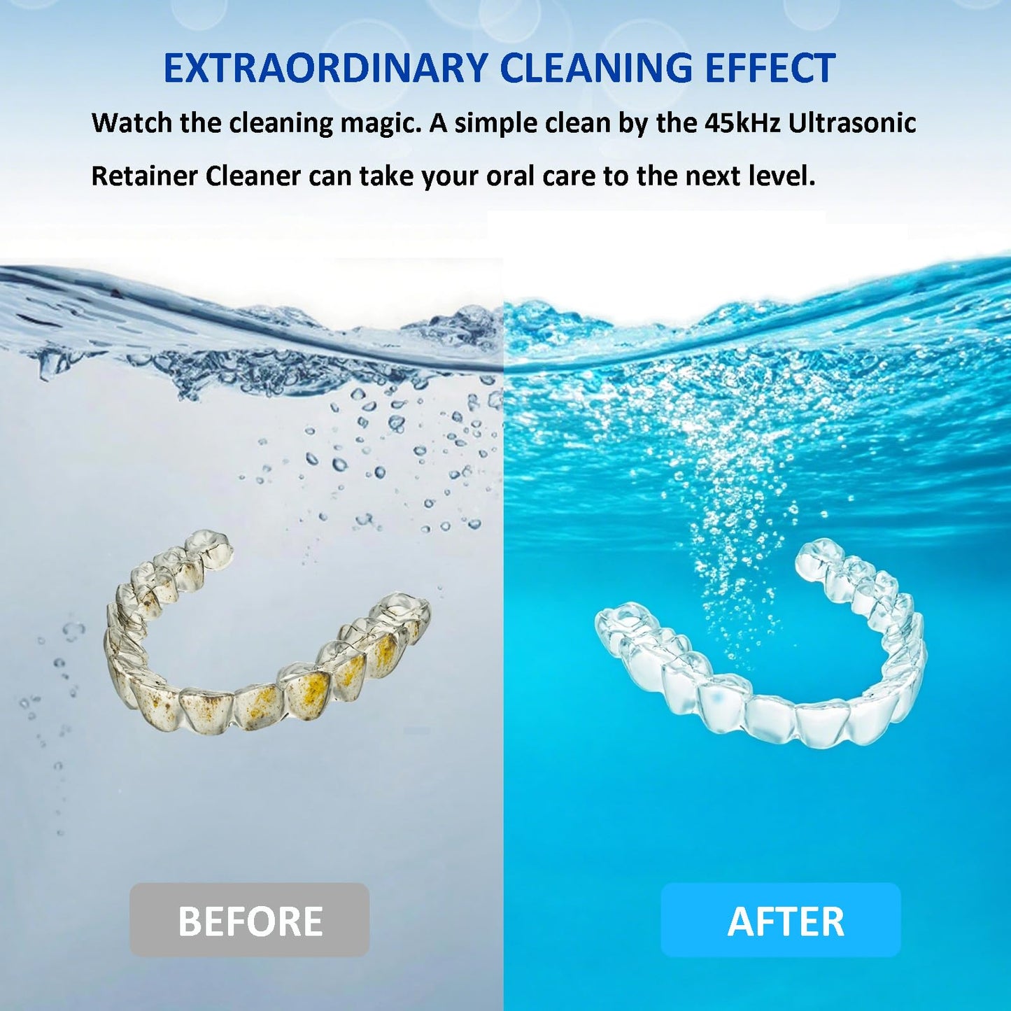 2025 Upgraded Ultrasonic Retainer Cleaner with Dryer Fan – 45kHz UV Cleaning Pod (White) | Dentures, Aligners & Jewelry