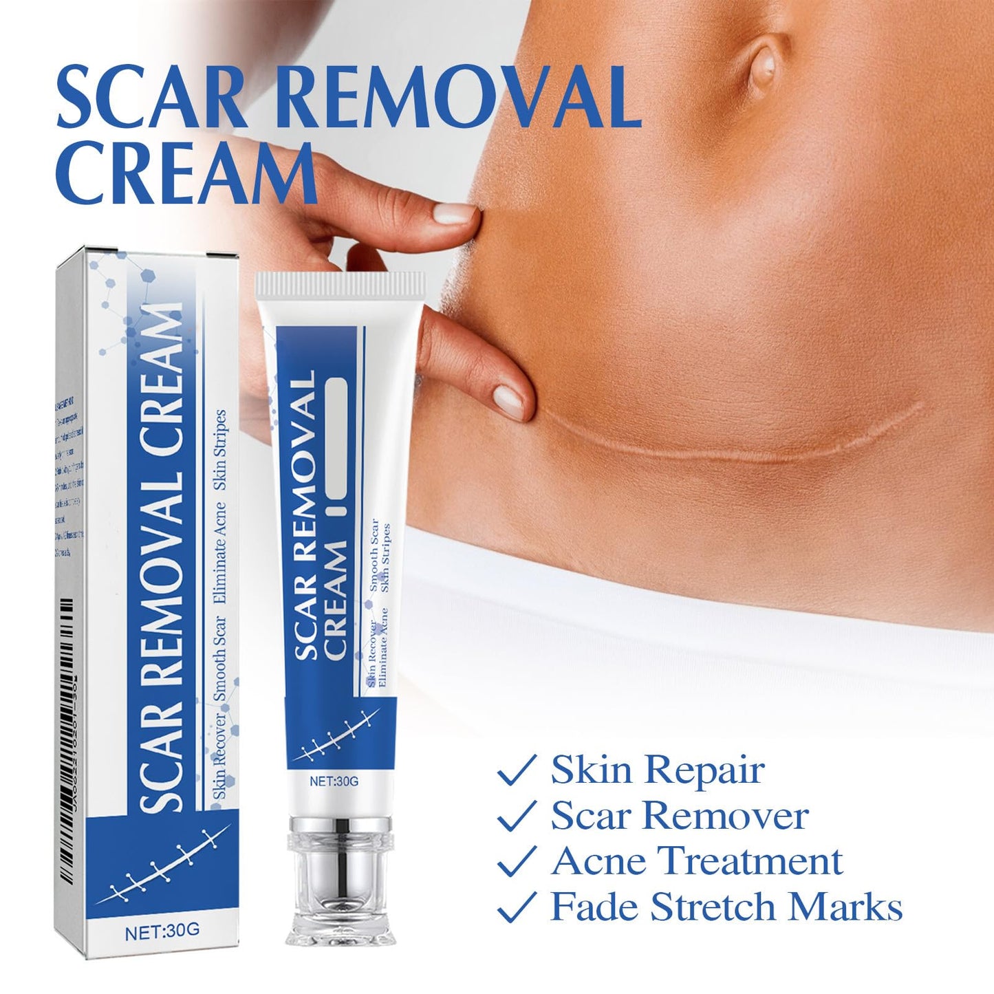 URABOS Scar Cream + Silicone Gel — Scar Treatment for Surgical Scars, Stretch Marks & Keloids (2pcs)
