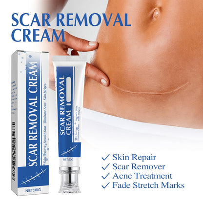 URABOS Scar Cream + Silicone Gel — Scar Treatment for Surgical Scars, Stretch Marks & Keloids (2pcs)