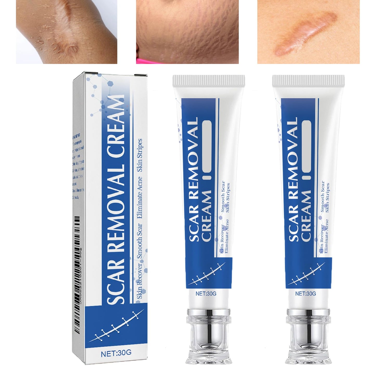 URABOS Scar Cream + Silicone Gel — Scar Treatment for Surgical Scars, Stretch Marks & Keloids (2pcs)