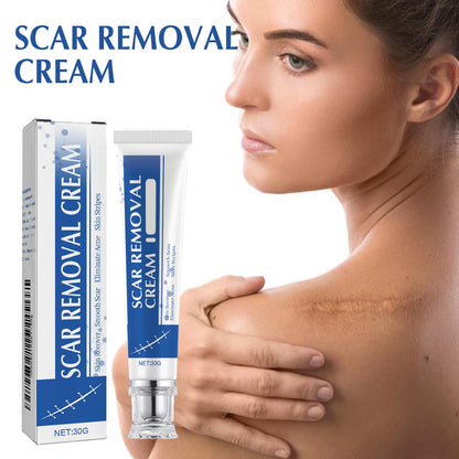 URABOS Scar Cream + Silicone Gel — Scar Treatment for Surgical Scars, Stretch Marks & Keloids (2pcs)