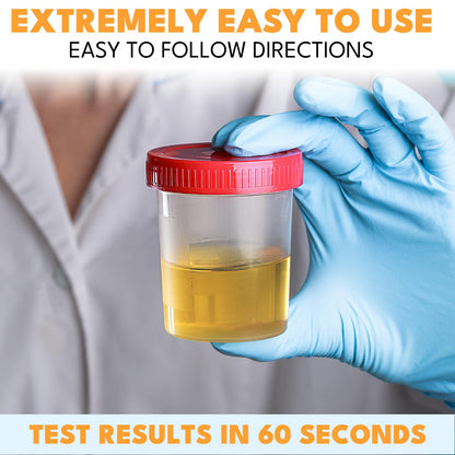 URS Urinalysis Test Strips – Leukocytes & Nitrites (UTI), OTC, 120 Strips