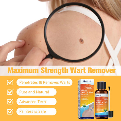 URSEORY Skin Tag Remover — Fast-Acting Wart Freeze Off with 12% Salicylic Acid (A4)