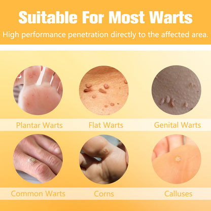URSEORY Skin Tag Remover — Fast-Acting Wart Freeze Off with 12% Salicylic Acid (A4)