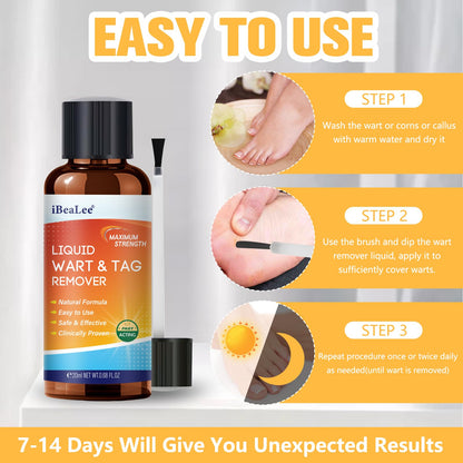 URSEORY Skin Tag Remover — Fast-Acting Wart Freeze Off with 12% Salicylic Acid (A4)