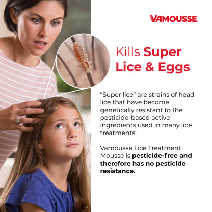 Vamousse Lice Treatment Mousse – Pesticide-Free, Non-Toxic, Kills Super Lice & Eggs (6 oz)