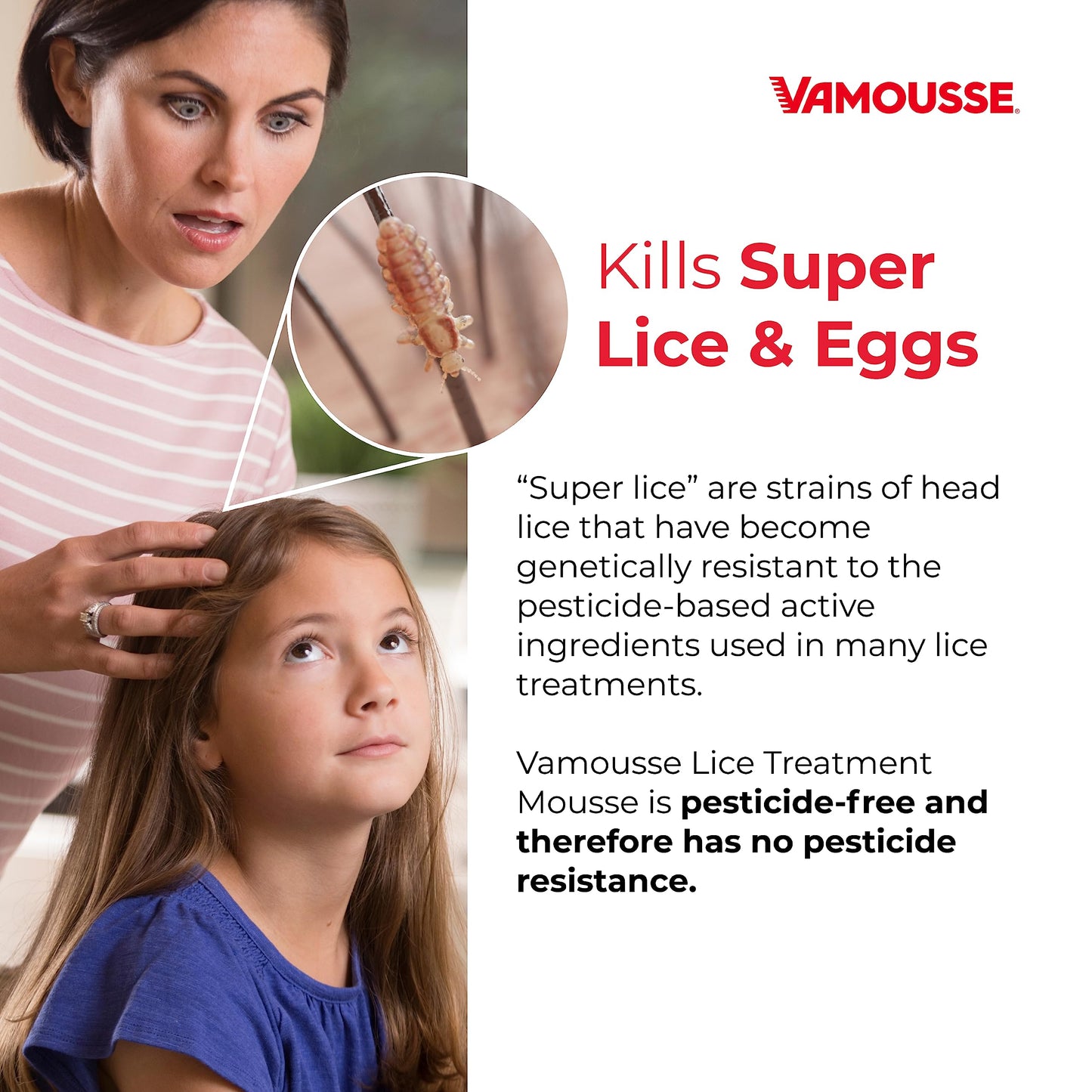 Vamousse PRO Lice Emergency Kit – Fast-Acting Mousse, Daily Shampoo, Repellent & Comb for All Ages