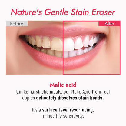 Vebanler MALIC Acid Teeth Whitening Toothpaste - Natural Care, Fluoride-Free, Non-Toxic, 3.57oz