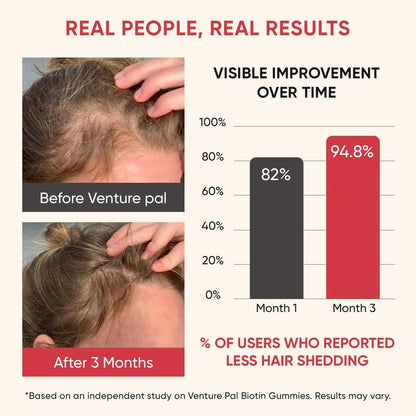 Venture Pal Biotin Gummies with Collagen & Keratin – Hair & Skin Support (60ct)
