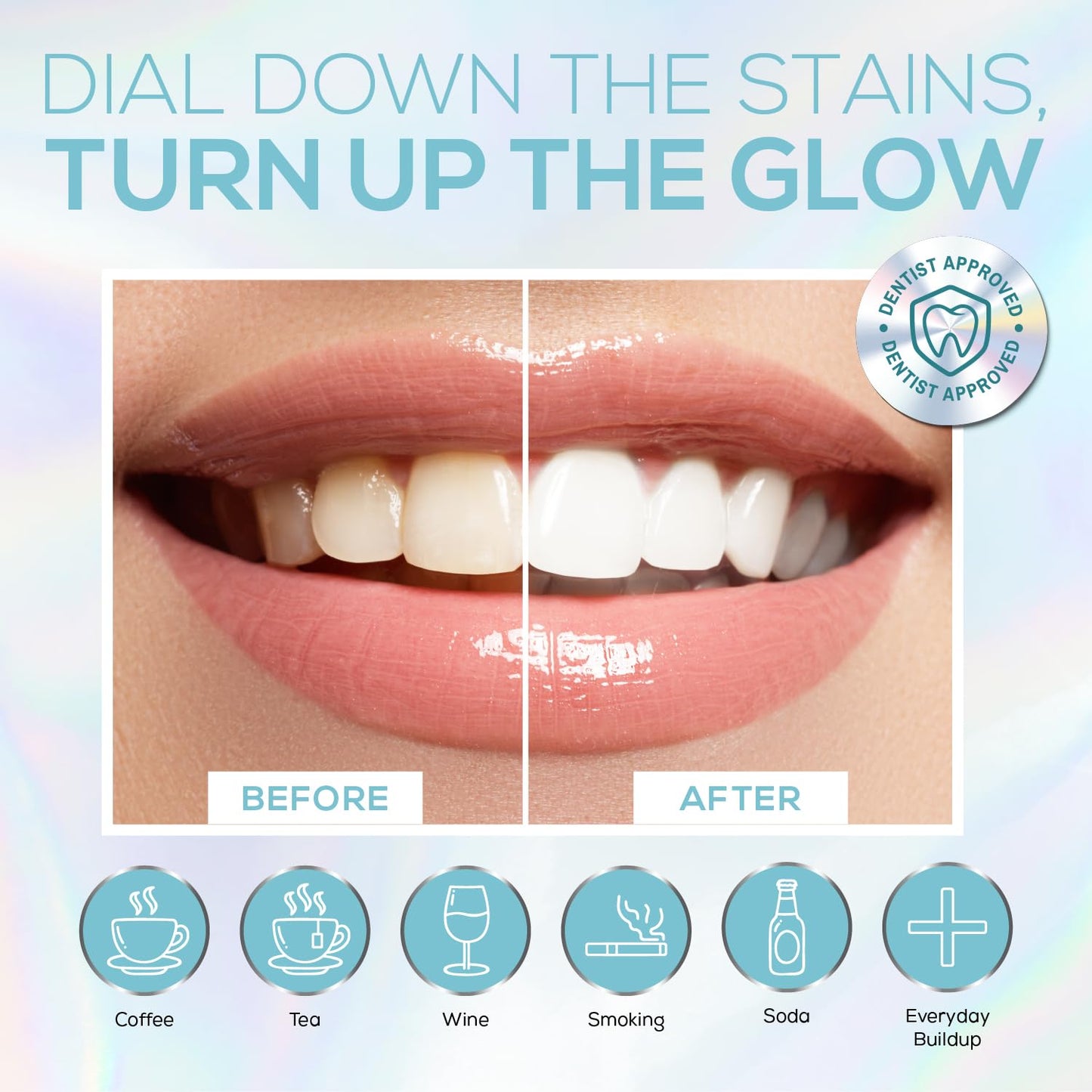 Venus Visage LED Teeth Whitening Kit – 4x 35% Carbamide Peroxide, Remineralization Gel, LED Light, Trays & Shade Guide