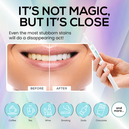 Venus Visage Teeth Whitening Gel Refill Kit (8 Pack) - 35% Carbamide Peroxide