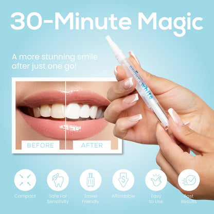 Venus Visage Award-Winning Teeth Whitening Pen – 20+ Uses, Mint (0.07 Fl Oz x4)