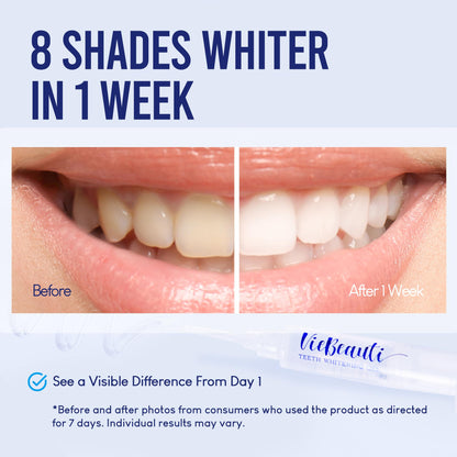 VieBeauti LED Teeth Whitening Kit – Sensitive Teeth, 35% Carbamide Peroxide