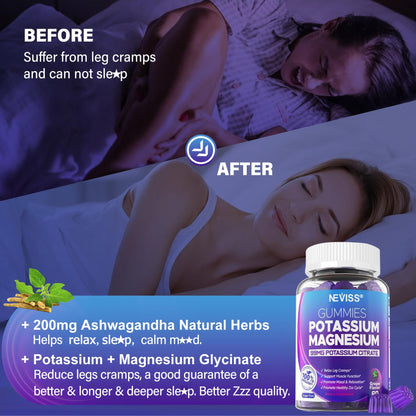 Potassium Magnesium Gummies – Ashwagandha, Magnesium Glycinate, B6 & B12, Potassium Citrate | Sugar-Free Electrolyte Gummies for Leg Cramps and Muscle (1 Pack)
