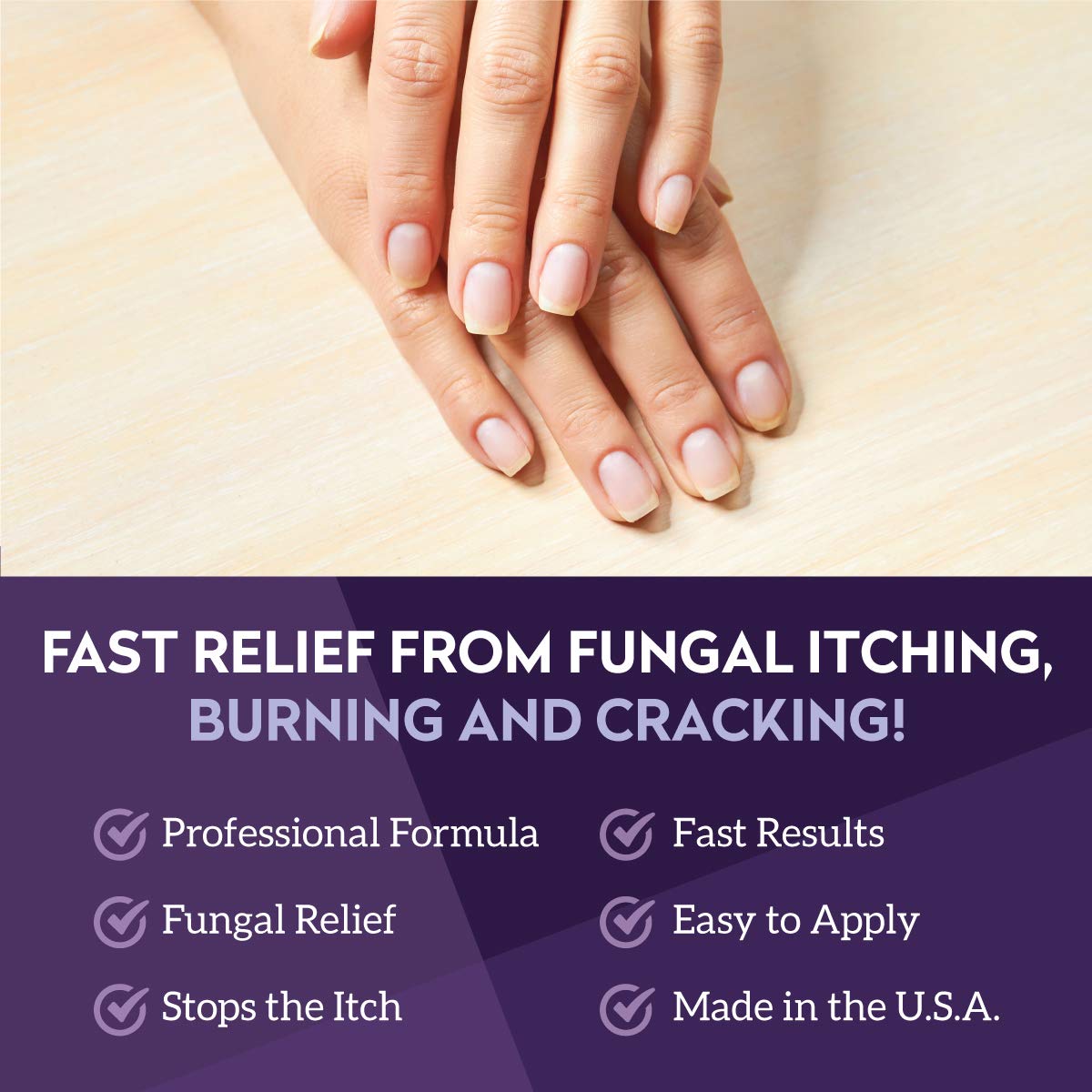 VITÉ20 V20 Antifungal Cream for Hands & Feet | Nail & Skin Care