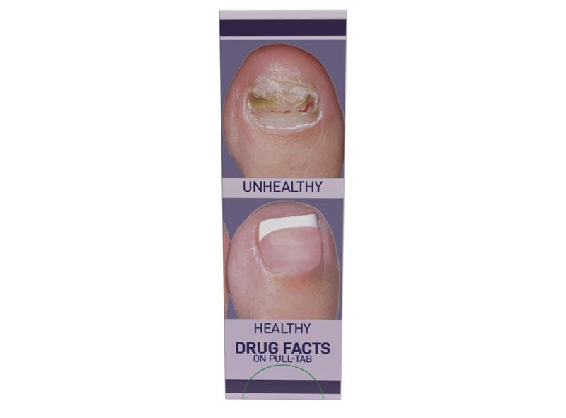 VITÉ20 V20 Antifungal Cream for Hands & Feet | Nail & Skin Care